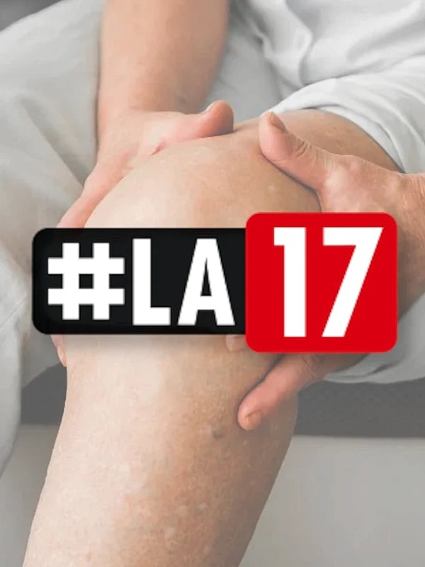 Knee treatment with hashtag LA17 overlay.