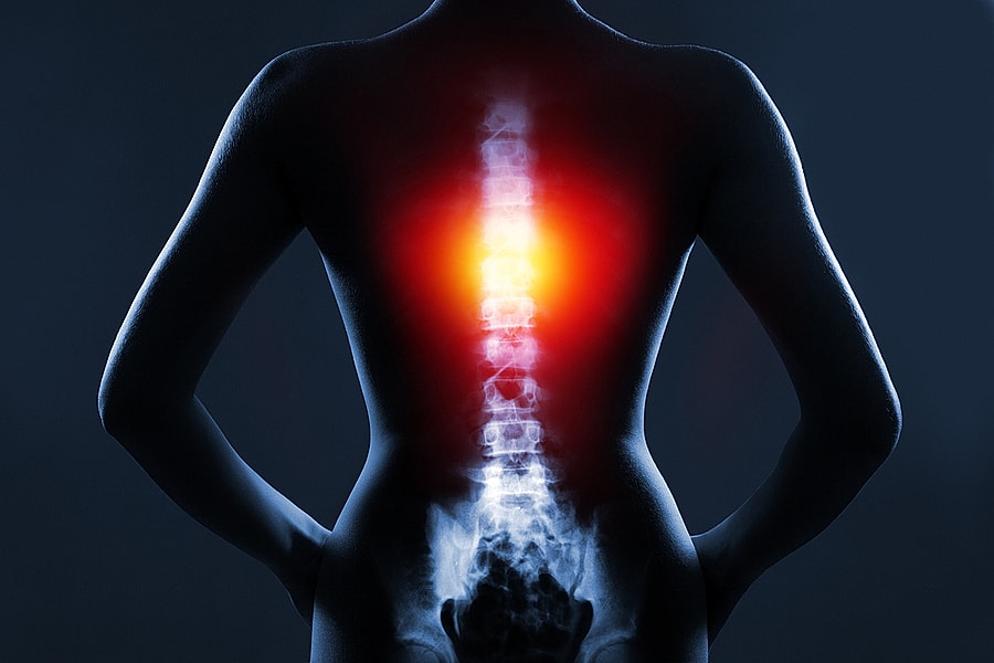 Spinal Ligaments
