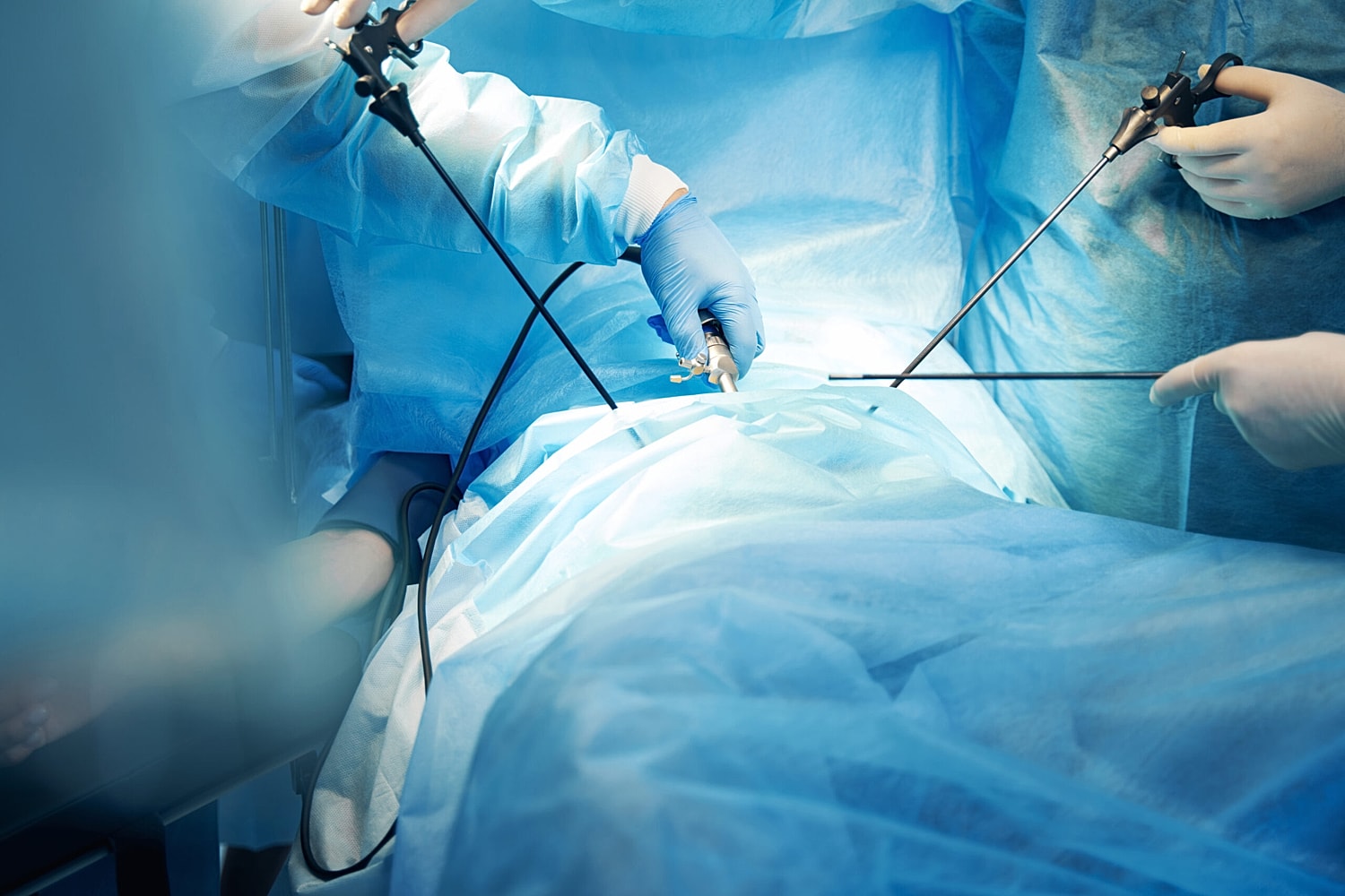 Surgical procedure with instruments and sterile environment.
