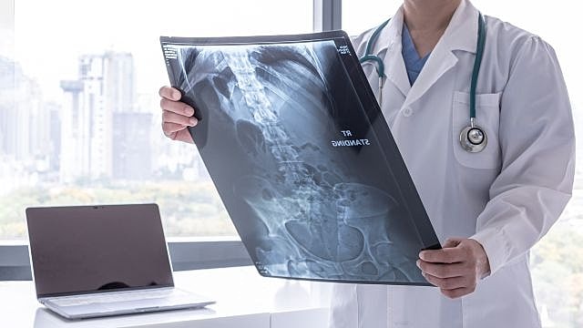 Robotic Spine Surgery Explained: Is It Right for You?