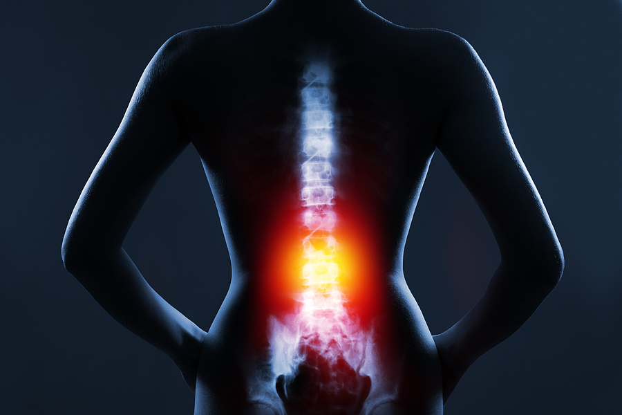 spinal decompression surgery