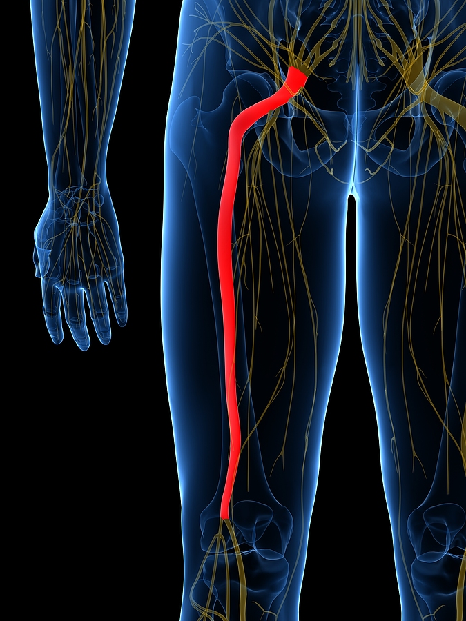 Sciatica treatment near me