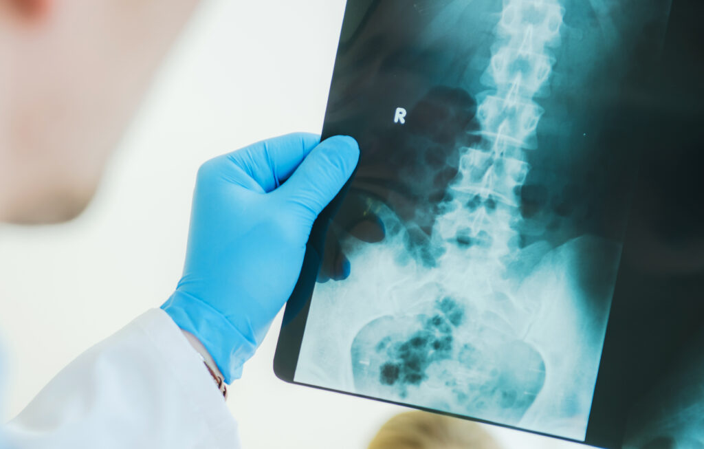 minimally invasive spine surgery procedures